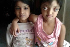 7岁女孩因病眼睛酷似“青蛙眼”，被称为“蛙人”遭受歧视