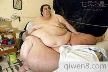 世界上胖的最快的人