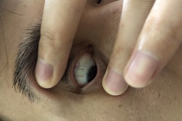 请懂的师傅帮忙看看眼睛红线有没有问题,谢谢
