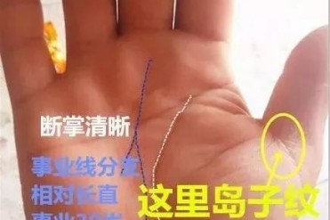手相“这儿”岛子纹,是福不是祸,后半生金钱不断...
