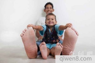 世界上最长的脚:脚长40.1厘米