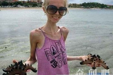 世界上最瘦的三个女人 真正的皮包骨头!