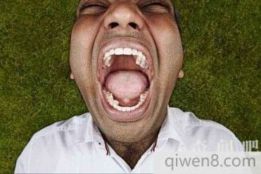 世界上最多牙齿的人:足足有37颗