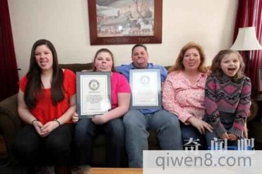 世界上最宽的舌头 舌宽比苹果6plus还要宽