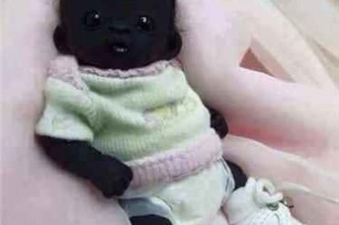 世界上最黑的孩子 黑的像煤球