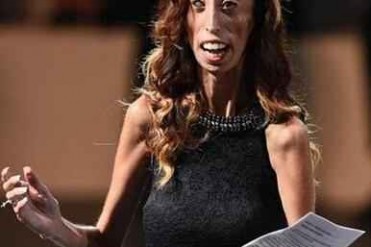 世界上最丑的女人以笑来面对恶言
