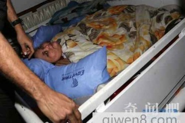 世界上最重的女子 需飞机运输去治疗