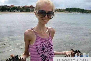 谁是世界上最瘦的女人 个个都是真正的皮包骨头