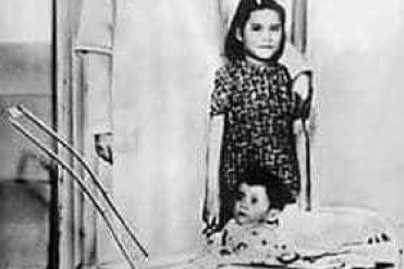 世界最小的母亲仅有5岁剖腹产下男婴