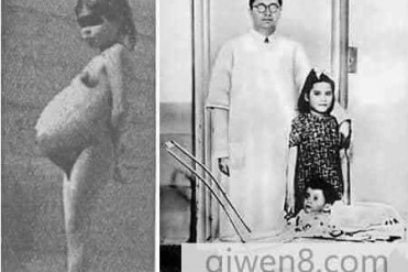 惊叹!世界上年仅5岁最年轻妈妈