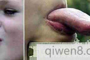 世界最长的舌头长达9.8厘米获吉尼斯世界纪录