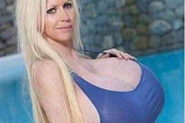 世界最大胸女人整形20次 死在巨乳上