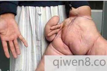 世界上最大的手指