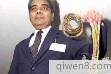 世界上最长的指甲长度达到8.65米