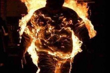 男子没供氧下全身燃烧破吉尼斯记录