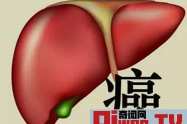 肝癌发病率最高的国家排名 埃及榜上第四 第一酒...