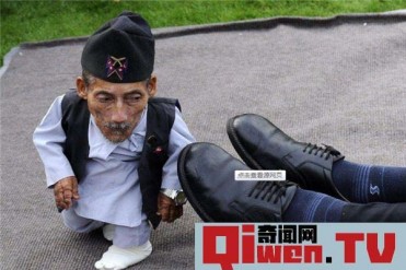 世界上最小的人排行榜前五名 因为疾病而变得矮小