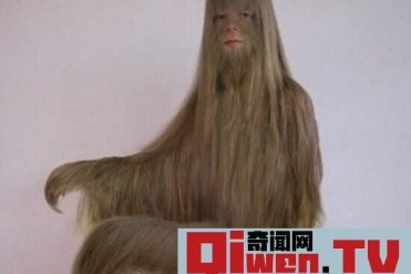 世界上体毛最多的女孩 艾米丽 苏珊 比猿人还恐怖...