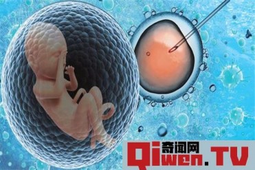 世界上最早的试管婴儿 来自伦敦的路易斯 布朗