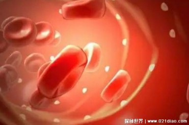 世界上最奇特的血液 粉红血液(遗传代谢病)