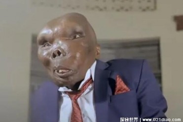 世界上最丑的男人 娶了两位妻子有8个孩子(整张脸...